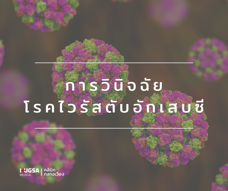 ตรวจไวรัสตับอักเสบซี รักษาไวรัสตับอักเสบซี เชียงใหม่ ยาไวรัสตับอักเสบซี หมอไวรัสตับอักเสบซี โรคตับ ตับแข็ง มะเร็งตับ