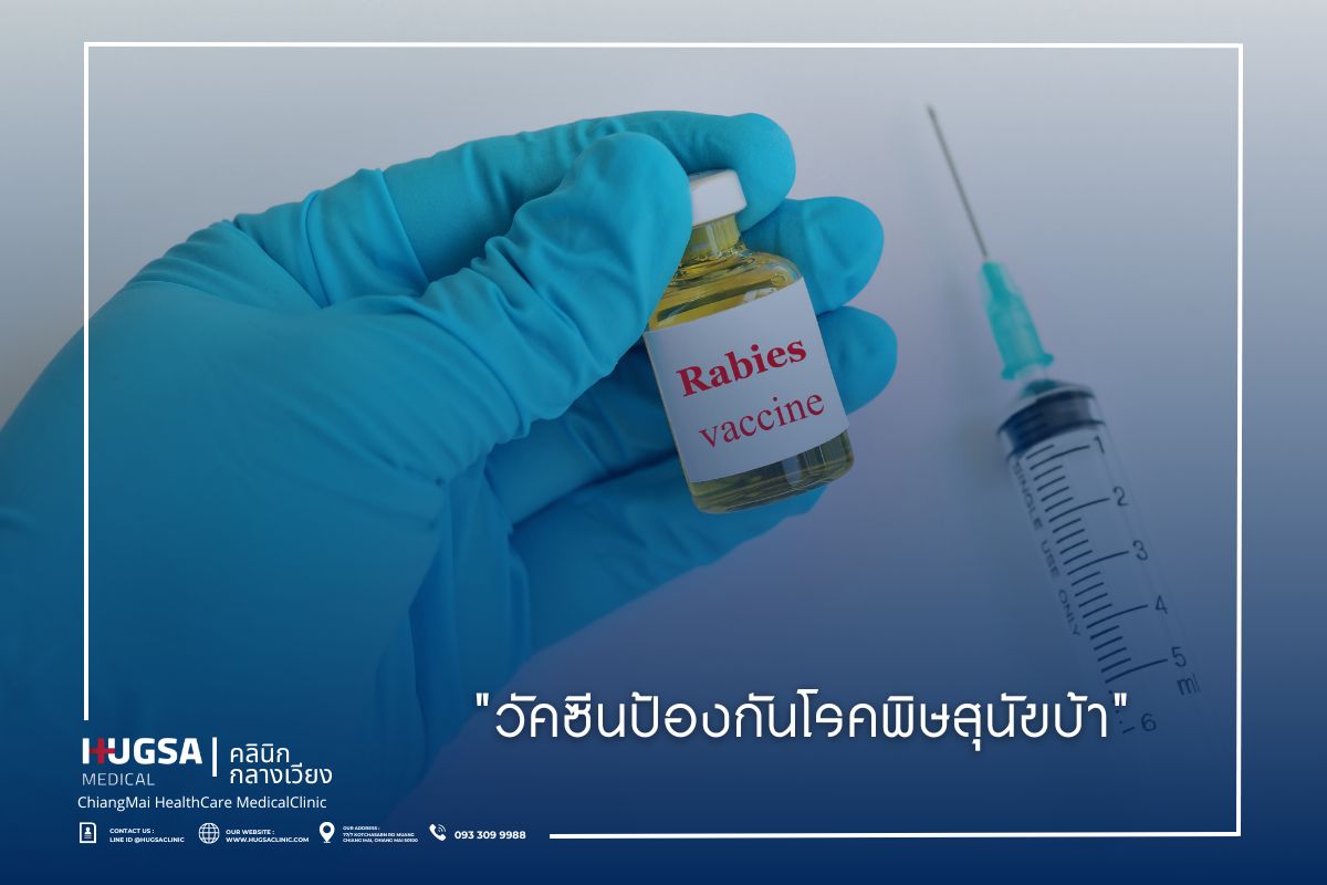 วัคซีนป้องกันโรคพิษสุนัขบ้า