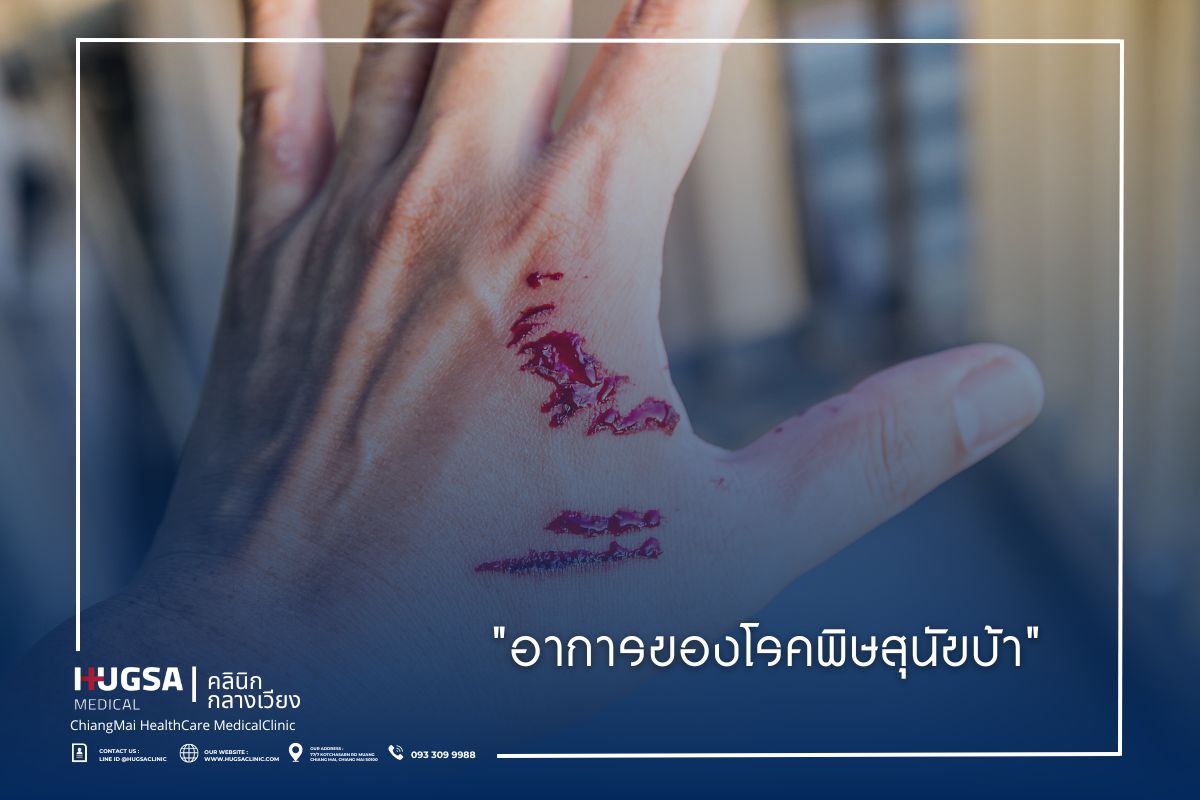 อาการของโรคพิษสุนัขบ้า