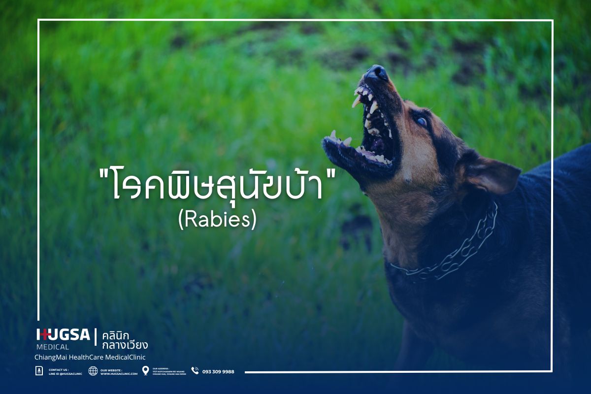 โรคพิษสุนัขบ้า (Rabies)