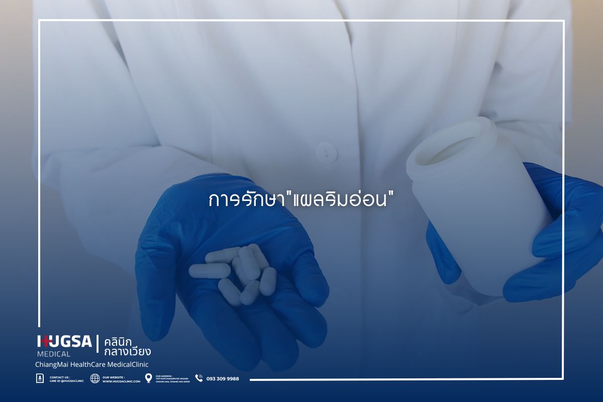 การรักษาแผลริมอ่อน (1)