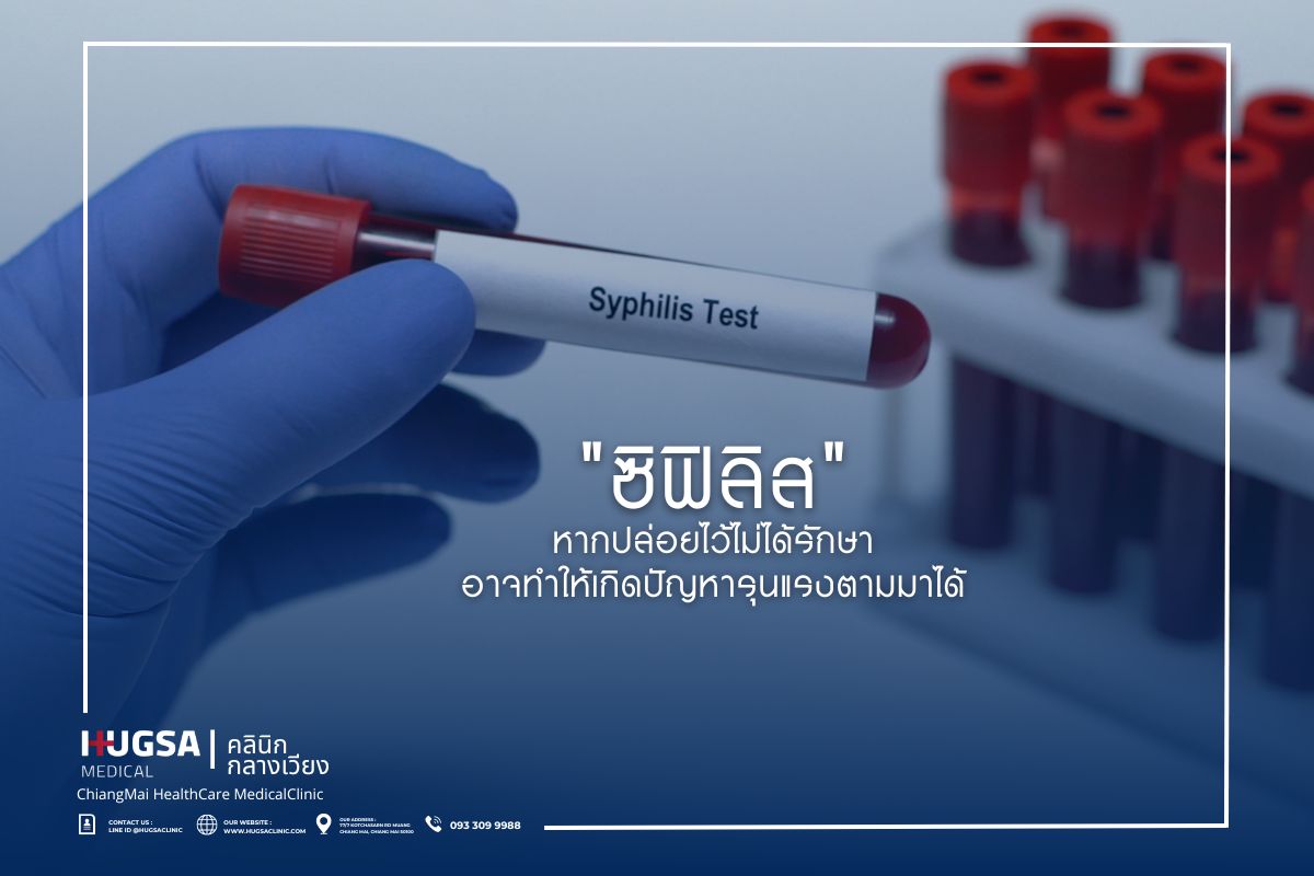 ซิฟิลิส (Syphilis) หากปล่อยไว้ไม่ได้รักษา อาจทำให้เกิดปัญหารุนแรงตามมาได้
