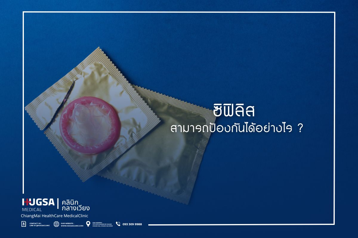 ซิฟิลิส สามารถป้องกันได้อย่างไร