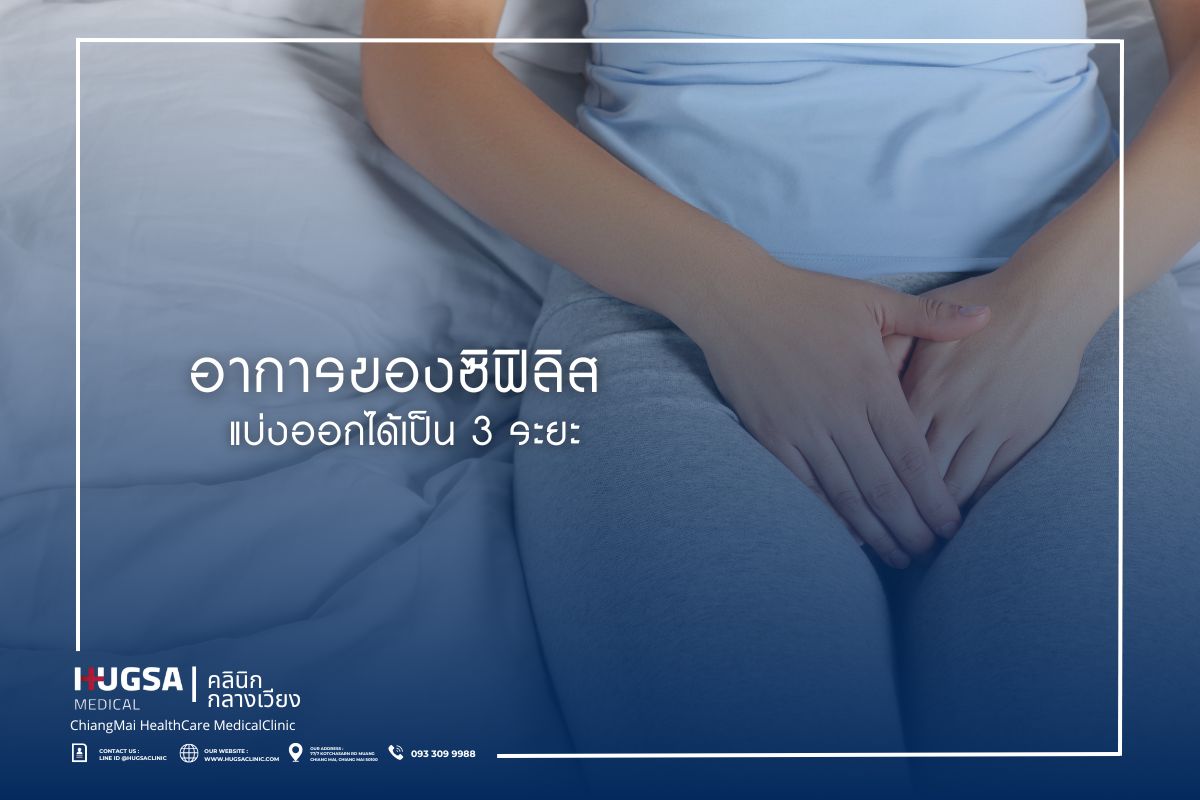 อาการของซิฟิลิส แบ่งออกได้เป็น 3 ระยะ