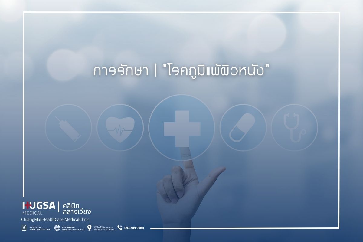 การรักษา โรคภูมิแพ้ผิวหนัง