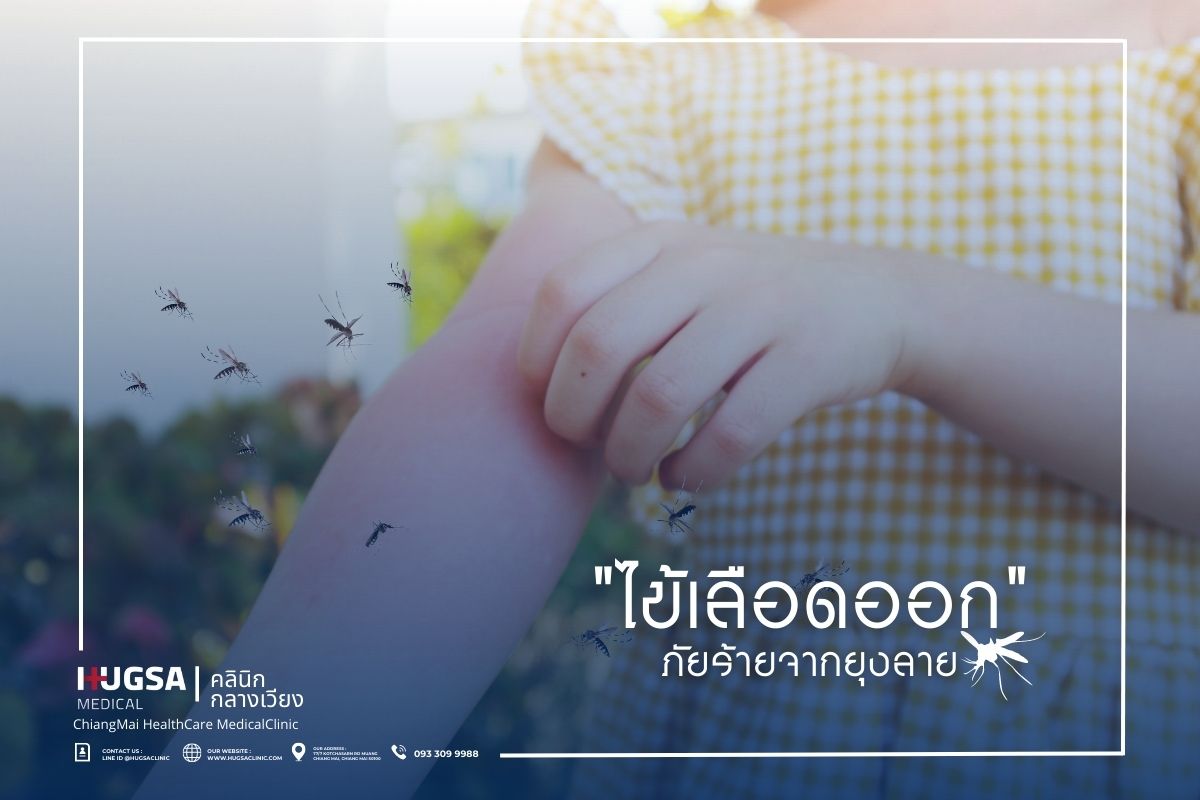 ไข้เลือดออก ภัยร้ายจากยุงลาย