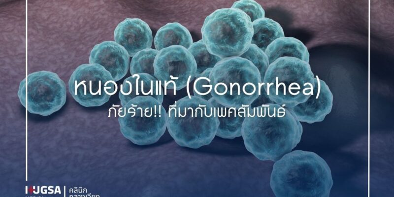 หนองในแท้ (Gonorrhea) ภัยร้าย!! ที่มากับเพศสัมพันธ์