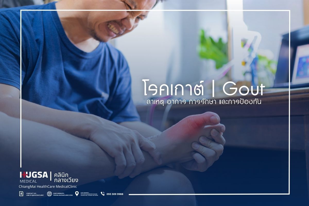 โรคเกาต์ Gout สาเหตุ อาการ การรักษา และการป้องกัน