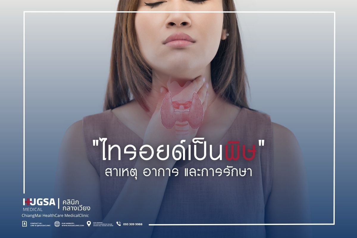ไทรอยด์เป็นพิษ สาเหตุ อาการ และการรักษา