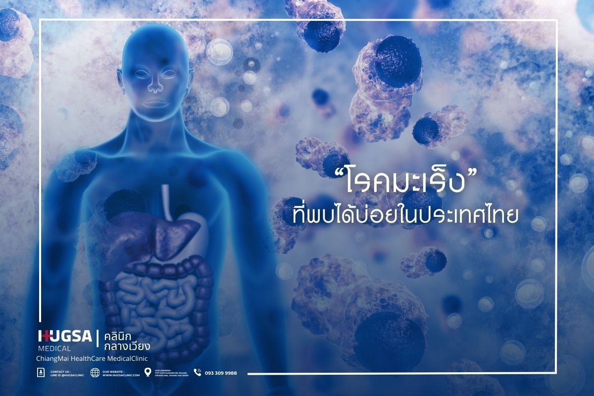 โรคมะเร็ง ที่พบได้บ่อยในประเทศไทย