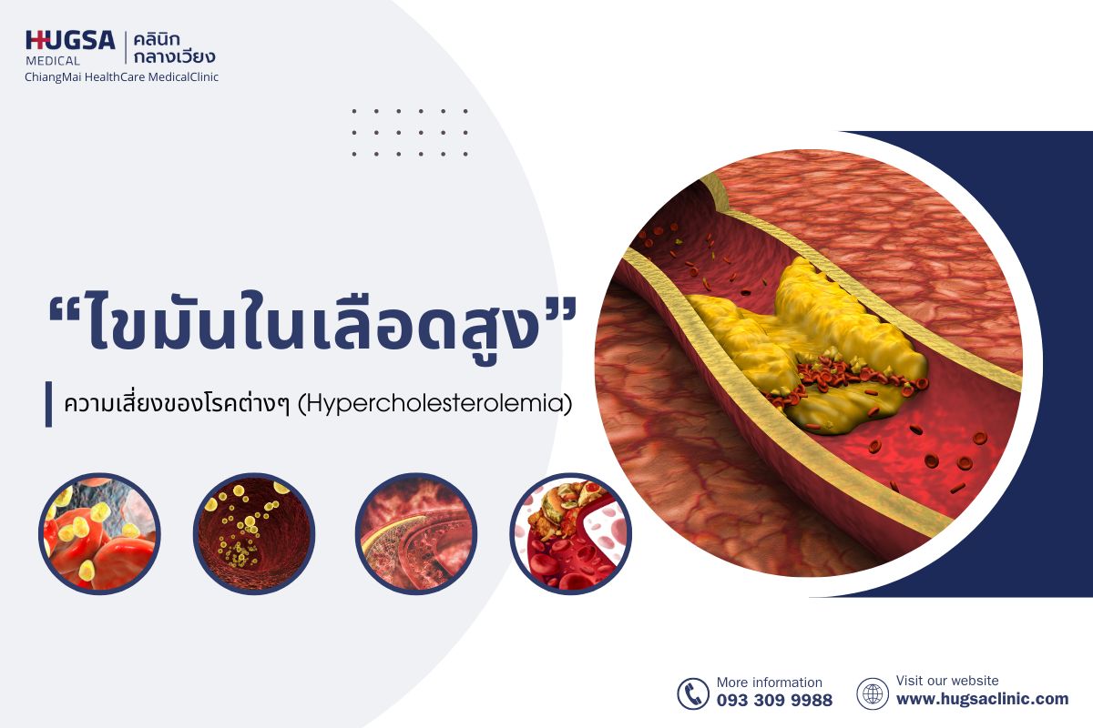 ไขมันในเลือดสูง ความเสี่ยงของโรคต่างๆ