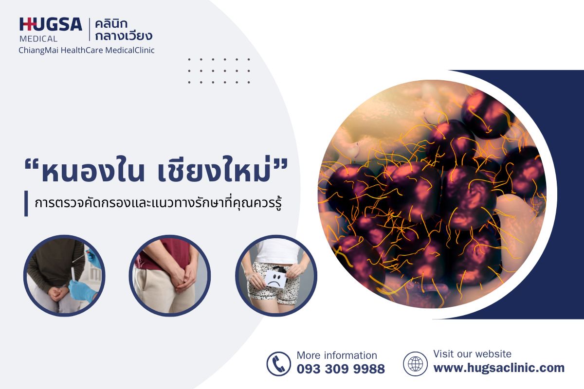 หนองใน เชียงใหม่ | การตรวจคัดกรองและแนวทางรักษาที่คุณควรรู้