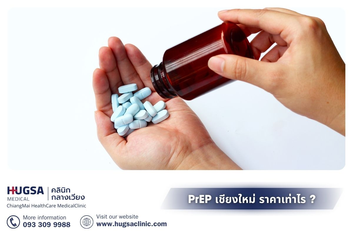 PrEP เชียงใหม่ ราคา เท่าไร และช่วงราคาที่ควรรู้