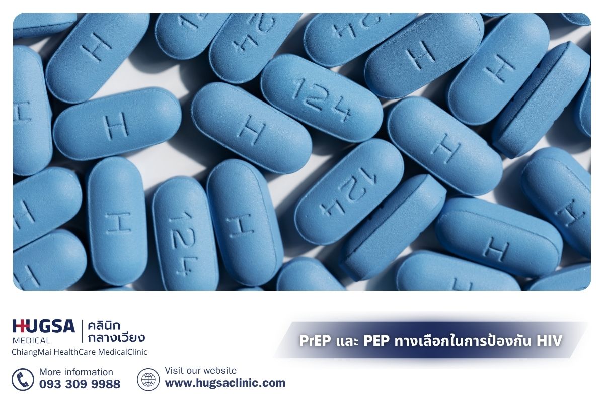 PrEP และ PEP ทางเลือกในการป้องกัน HIV