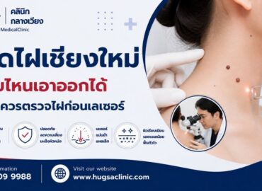 กำจัดไฝเชียงใหม่ ไฝแบบไหนเอาออกได้ และทำไมควรตรวจไฝก่อนเลเซอร์