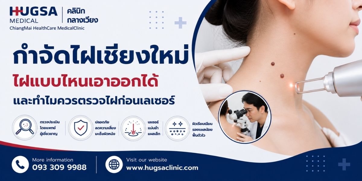 กำจัดไฝเชียงใหม่ ไฝแบบไหนเอาออกได้ และทำไมควรตรวจไฝก่อนเลเซอร์