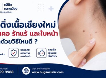 กำจัดติ่งเนื้อเชียงใหม่ บริเวณคอ รักแร้ และใบหน้า เอาออกด้วยวิธีไหนดี
