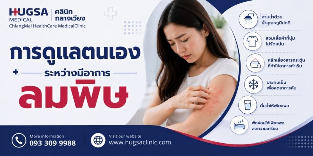 การดูแลตนเองระหว่างมีอาการลมพิษ