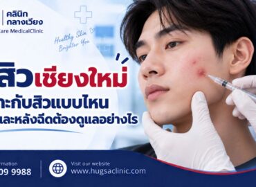 ฉีดสิวเชียงใหม่ เหมาะกับสิวแบบไหน กี่วันยุบ และหลังฉีดต้องดูแลอย่างไร
