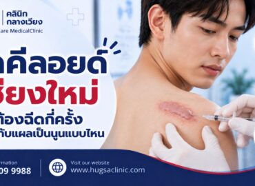 ฉีดคีลอยด์เชียงใหม่ ต้องฉีดกี่ครั้ง เหมาะกับแผลเป็นนูนแบบไหน