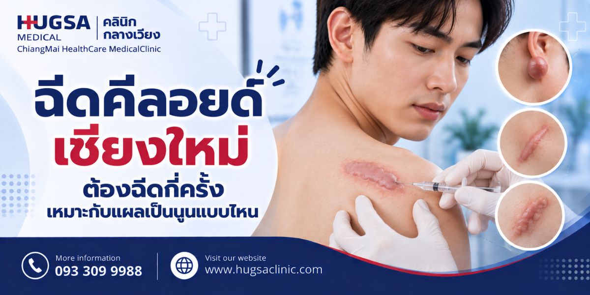 ฉีดคีลอยด์เชียงใหม่ ต้องฉีดกี่ครั้ง เหมาะกับแผลเป็นนูนแบบไหน