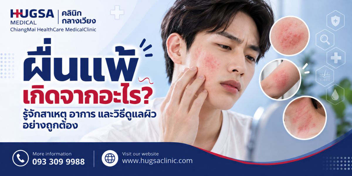 ผื่นแพ้ เกิดจากอะไร? รู้จักสาเหตุ อาการ และวิธีดูแลผิวอย่างถูกต้อง