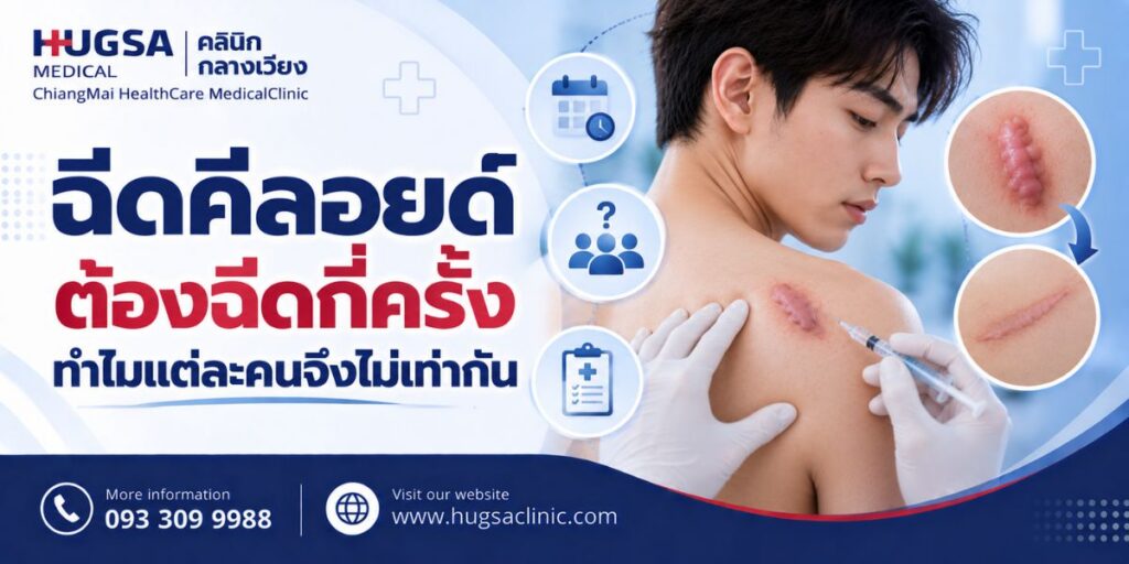 ฉีดคีลอยด์ต้องฉีดกี่ครั้ง ทำไมแต่ละคนจึงไม่เท่ากัน
