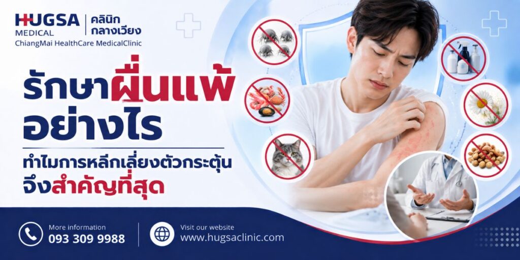 รักษาผื่นแพ้อย่างไร ทำไมการหลีกเลี่ยงตัวกระตุ้นจึงสำคัญที่สุด