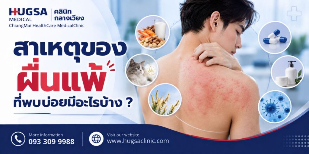 สาเหตุของผื่นแพ้ที่พบบ่อยมีอะไรบ้าง